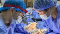 Chinese medical team performs Sierra Leone's first finger replantation