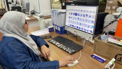 AI宫颈癌筛查技术呵护“她”健康